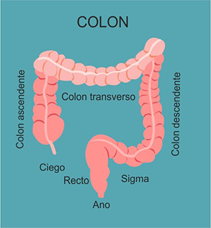 COLITIS-ULCEROSa